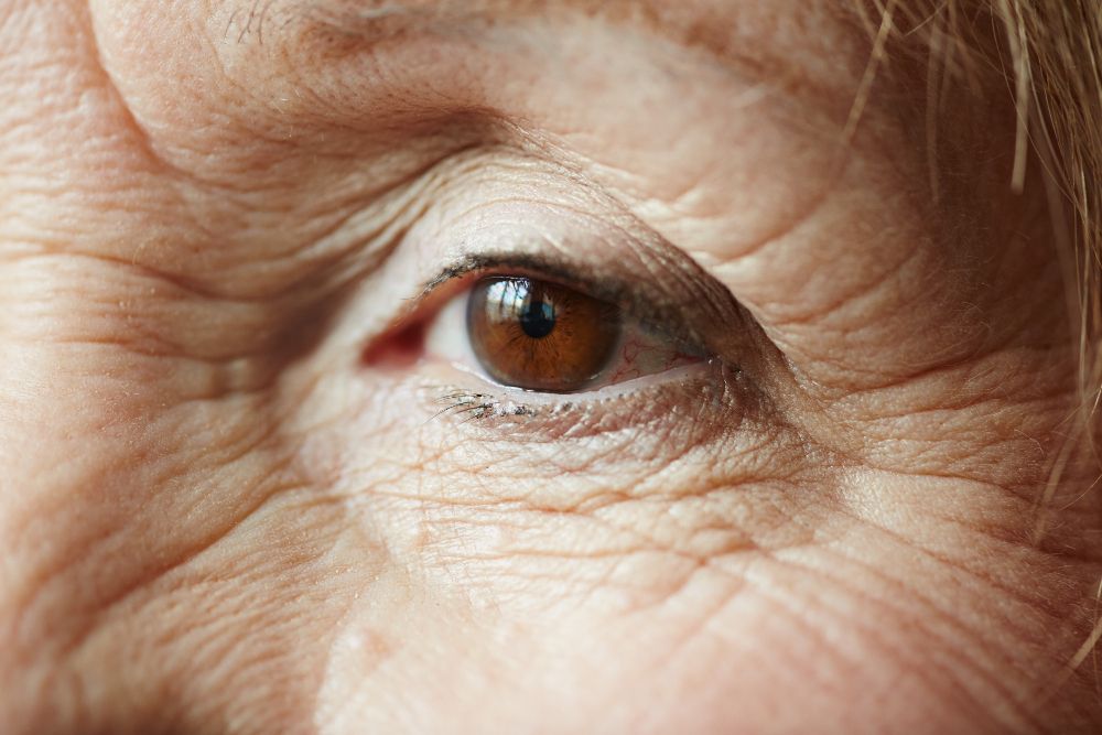 diabetik retinopatiya