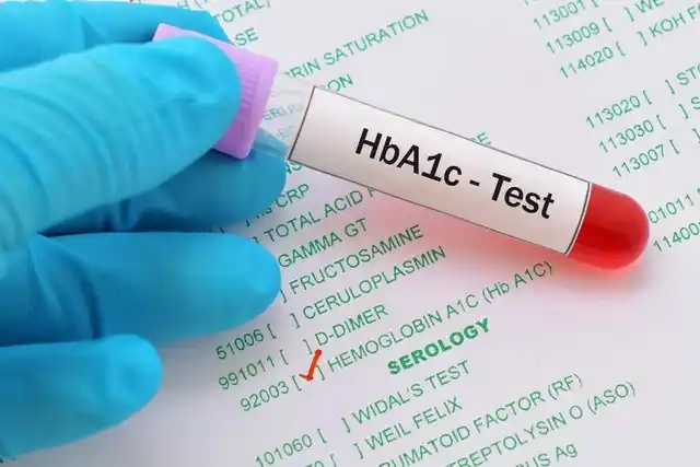 Qlikohemoqlobin (HbA1c) testi nədir?