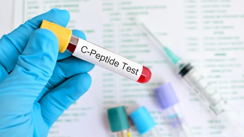 C Peptit analizi nədir? Nə üçün verilir?